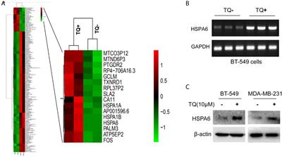 RNA-Sequencing Reveals Heat Shock 70-kDa Protein 6 (HSPA6) as a Novel Thymoquinone-Upregulated Gene That Inhibits Growth, Migration, and Invasion of Triple-Negative Breast Cancer Cells